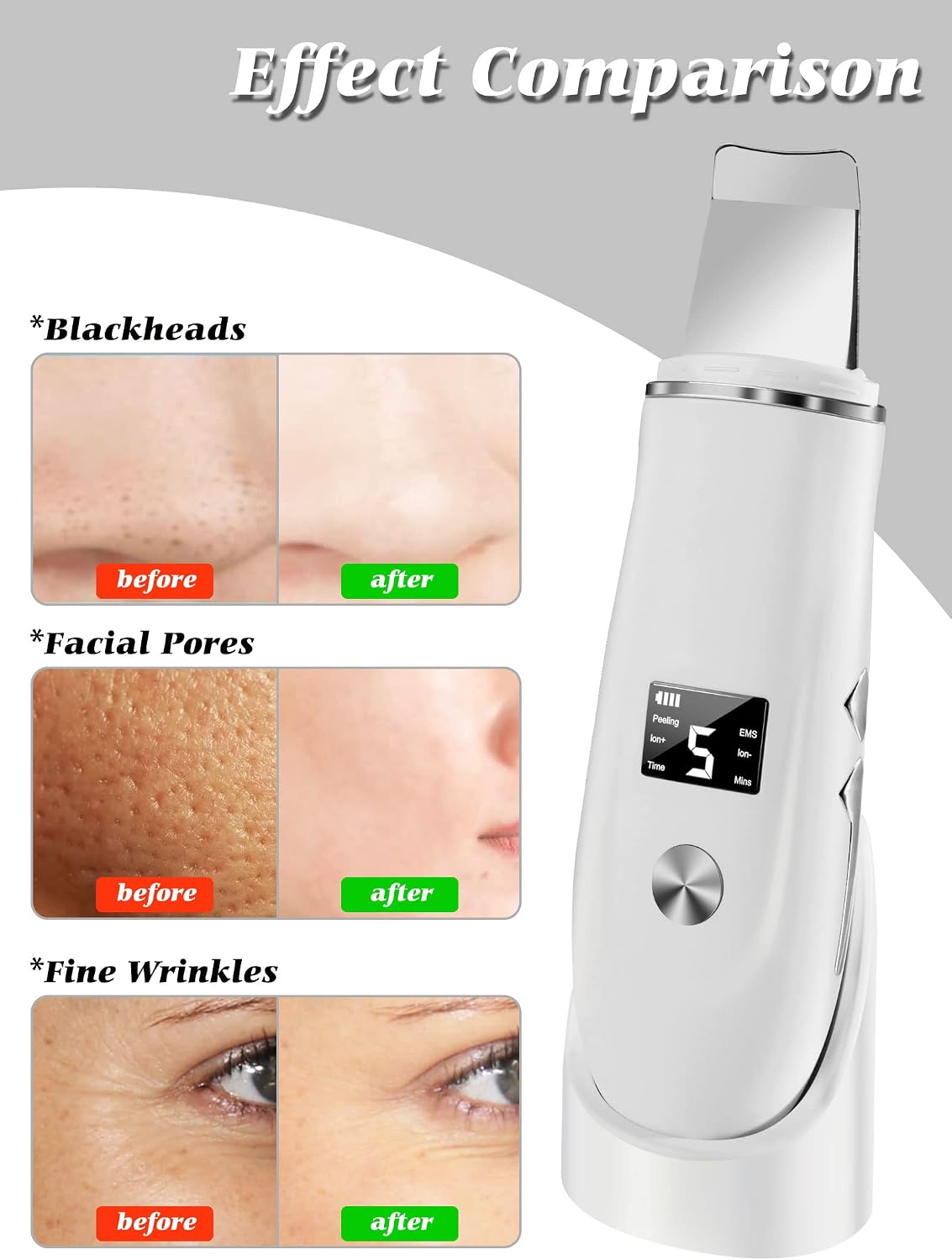 Ultrasonic Facial Skin Scrubber and Pore Cleansing Spatula Device