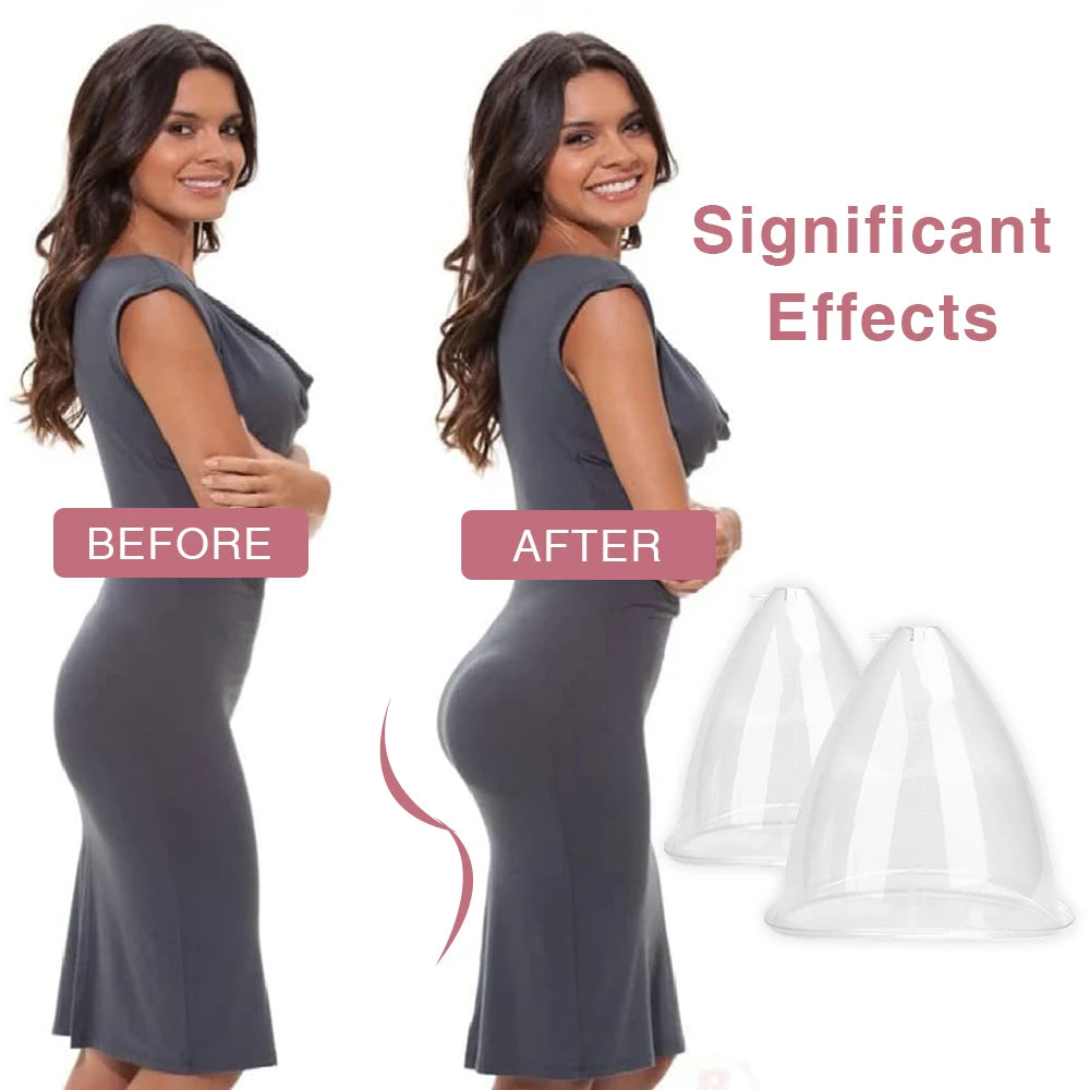 Vacuum Suction Cup Set for Breast Enhancement and Buttock Lifting - 6