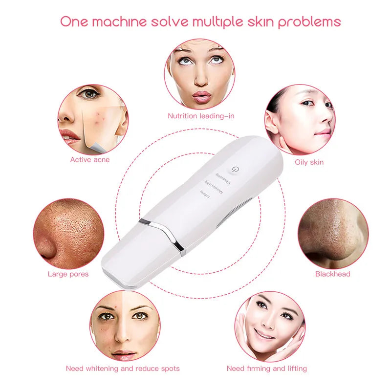 3-in-1 Ultrasonic Facial Skin Scrubber and Pore Cleaning Spatula