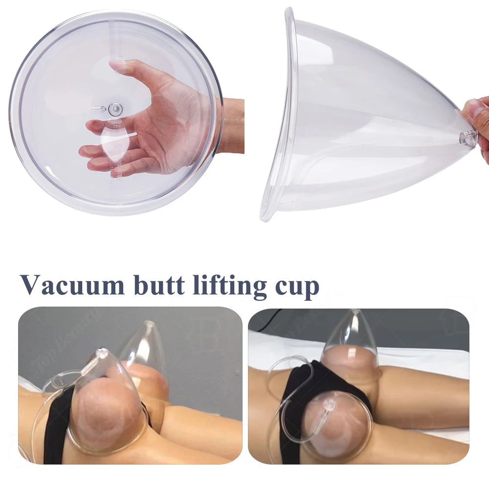Vacuum Suction Cup Set for Breast Enhancement and Buttock Lifting - 5