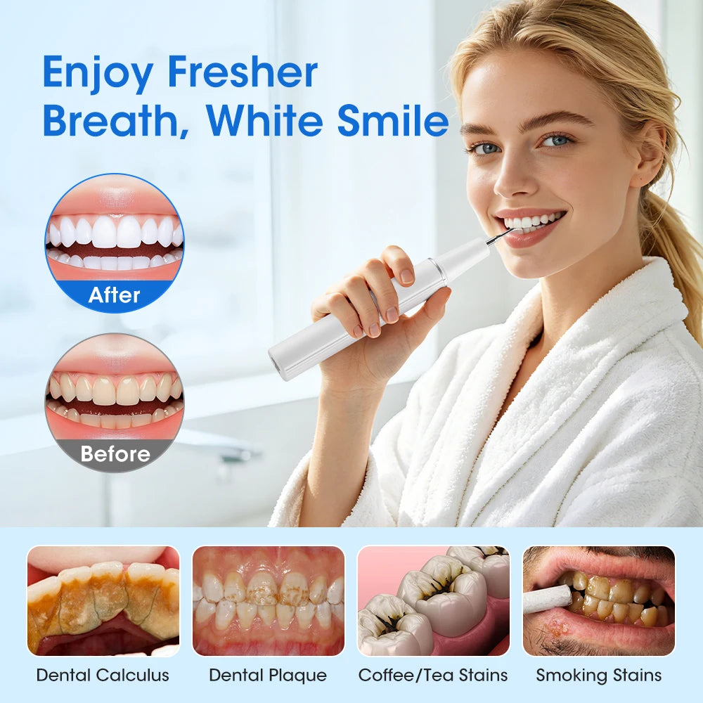Rechargeable Ultrasonic Teeth Cleaning Kit for Plaque and Tartar Removal - 5