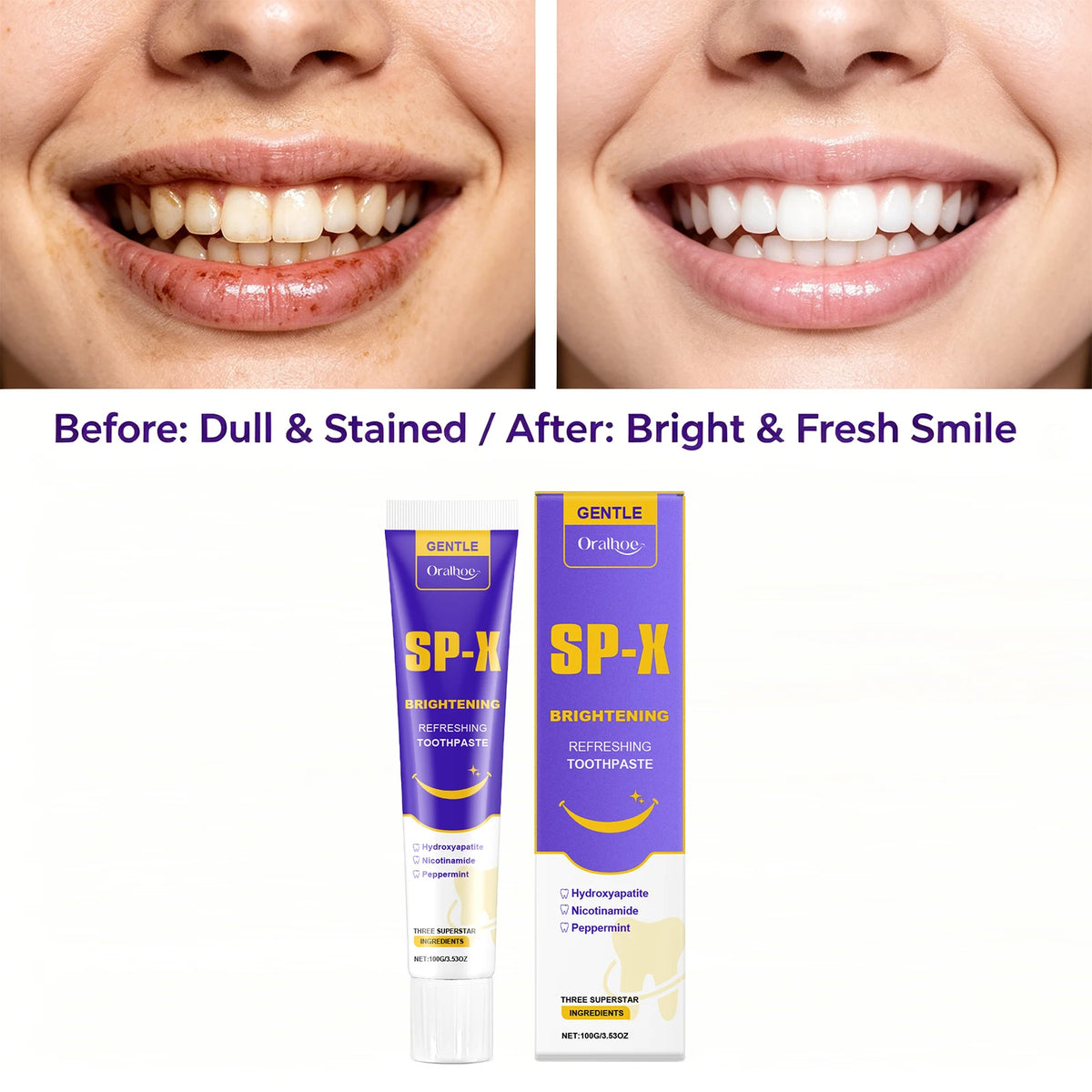 Brightening Toothpaste for Deep Stain Removal and Enamel Protection