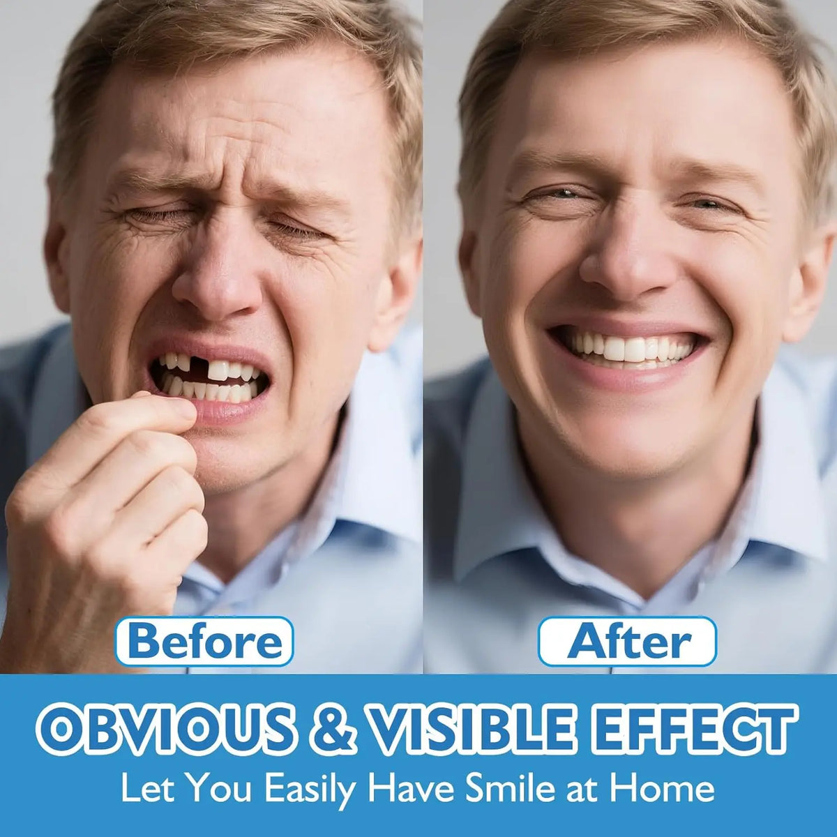 Comfortable Snap-On Dentures for Instant Realistic Smile