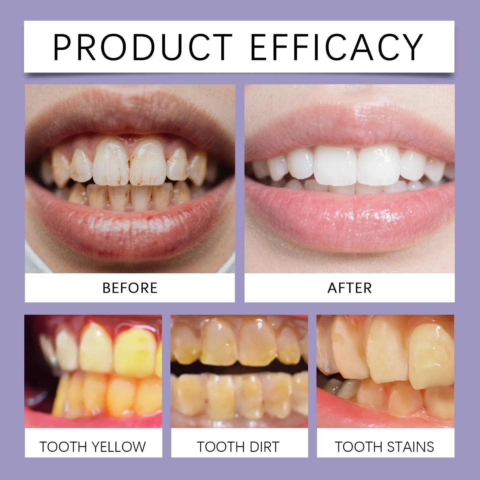 Bee Venom Gum Repair and Teeth Whitening Toothpaste - 11
