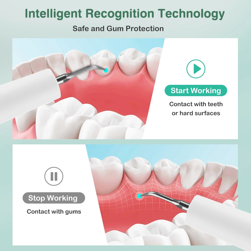 Ultrasonic Electric Dental Scaler for Professional Teeth Tartar Removal - 8