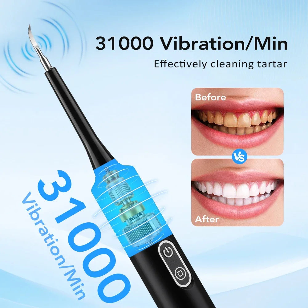 Electric Sonic Teeth Cleaner for Plaque and Tartar Stain Removal