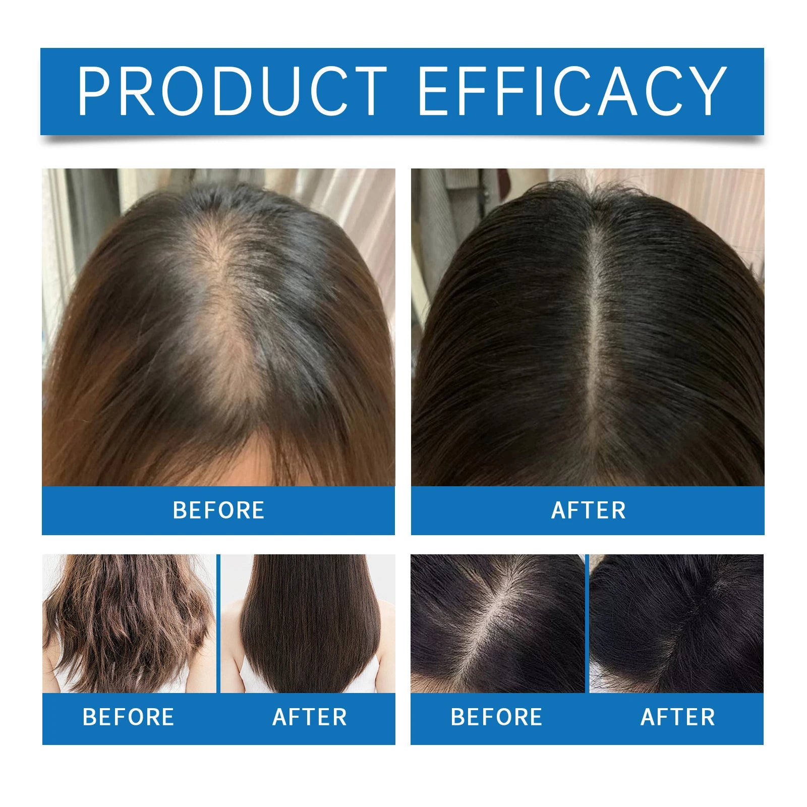 Rosemary Scalp Stimulating Roller Serum for Hair Growth and Thickness - 4