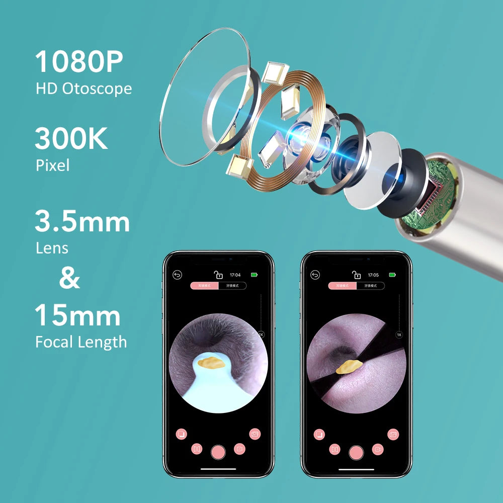 Smart Visual Ear Wax Removal Tool with HD Camera and Tweezers
