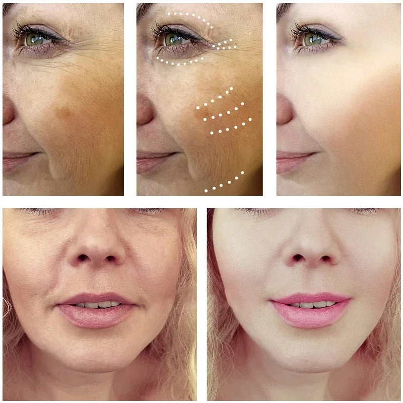 Anti-Aging Dragon Blood Facial Serum for Wrinkle Reduction and Firming