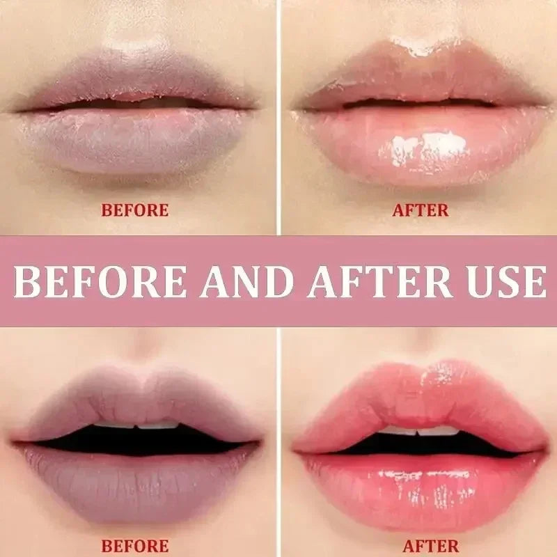 Moisturizing Lip Balm for Dark Pigmentation and Dryness Repair - 5