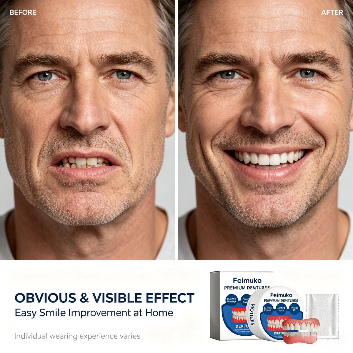 Comfortable Silicone Snap-On Dentures for Natural Smile and Instant Fit