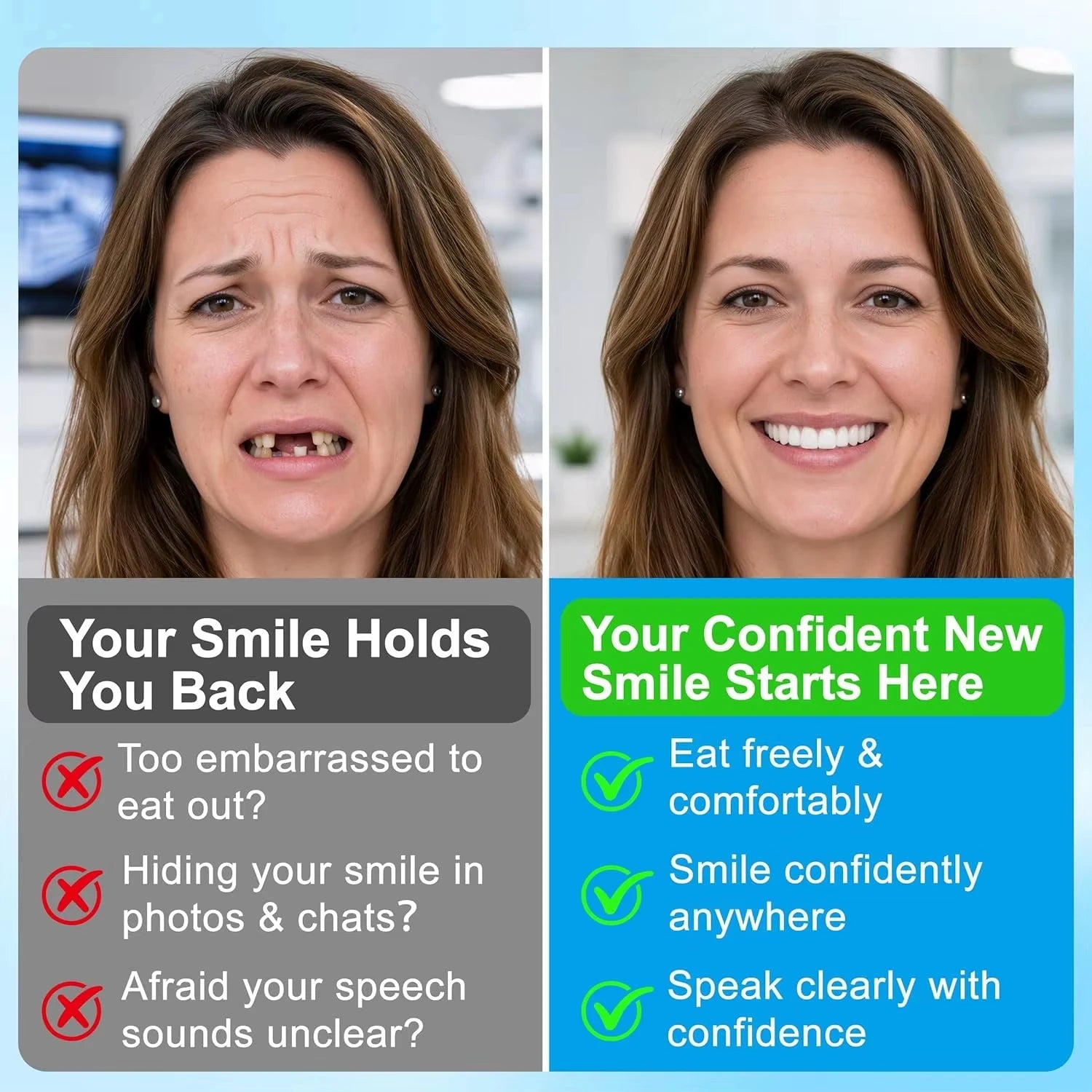 Custom Fit Temporary Denture Veneers for Instant Natural Smile Restoration - 3
