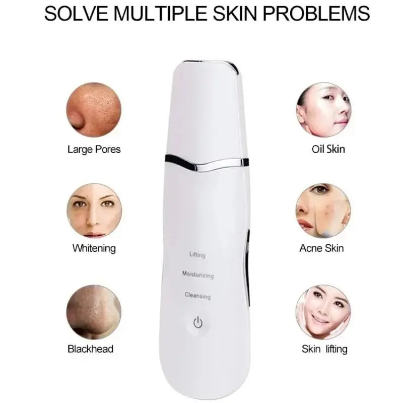 3-in-1 Ultrasonic Facial Skin Scrubber and Pore Cleaning Spatula