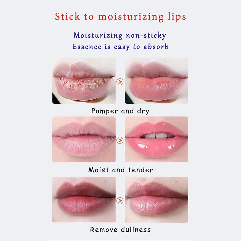 Moisturizing Lip Balm for Dark Pigmentation and Dryness Repair - 2