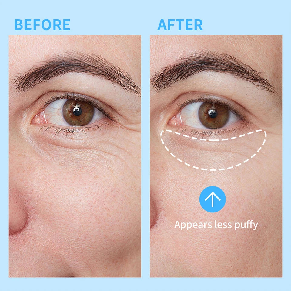 Cooling Eye Gel for Dark Circles and Puffiness Reduction - 11
