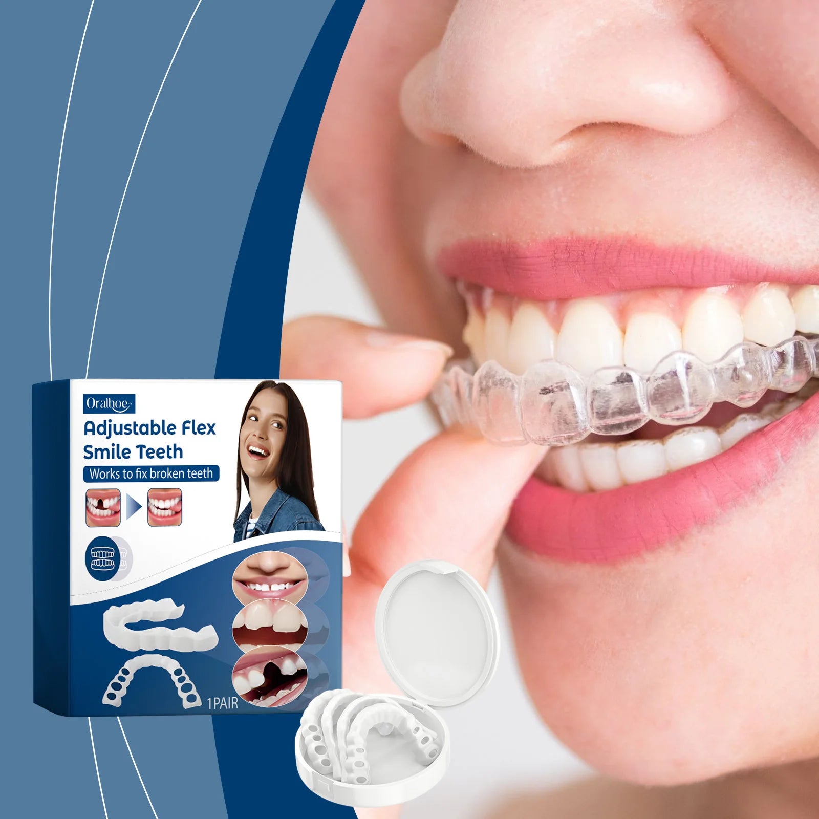 Adjustable Snap-On Silicone Dentures for Instant Smile Repair - 2
