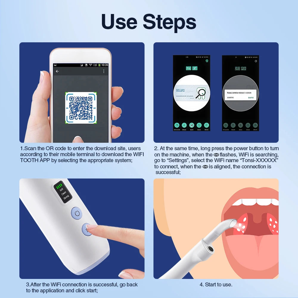 HD Visible Tonsil Stone Remover Vacuum for Painless Oral Care