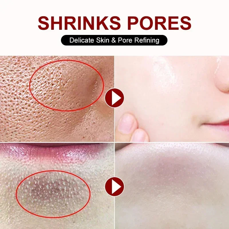 Salicylic Acid Pore Refining Cream for Smooth and Clear Skin