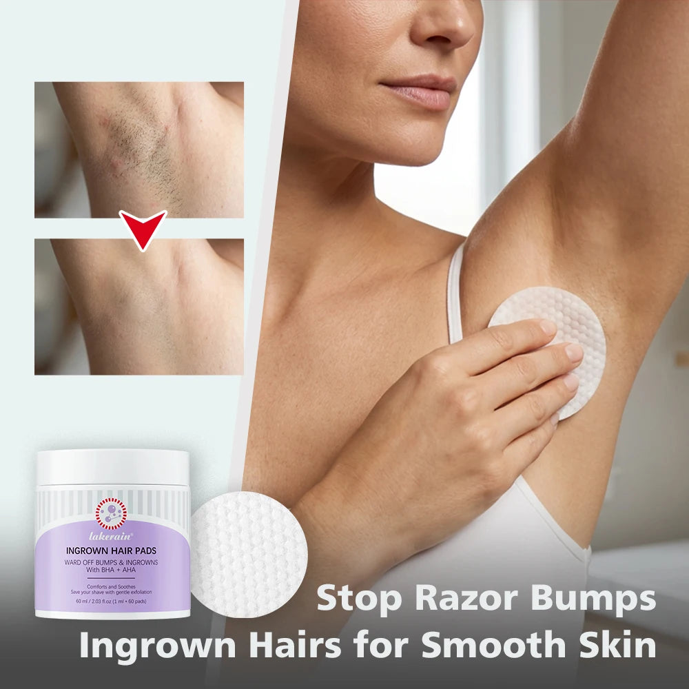 Exfoliating Ingrown Hair Treatment Pads for Razor Bumps and Irritation - 11