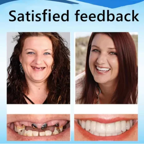 Custom Fit Silicone Dentures for Comfortable and Natural Looking Smile