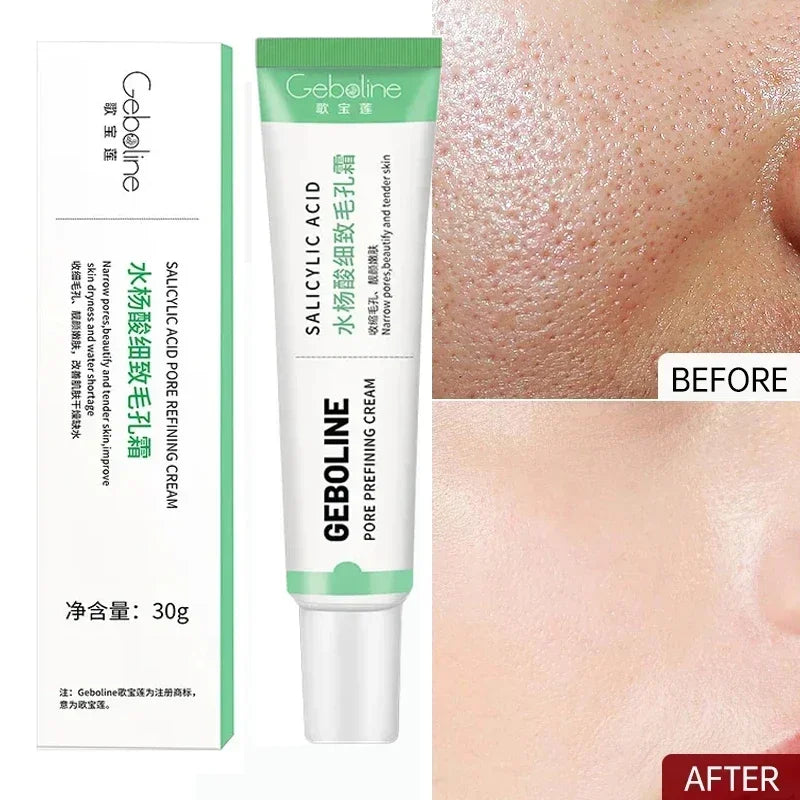 Salicylic Acid Pore Refining Cream for Smooth and Clear Skin