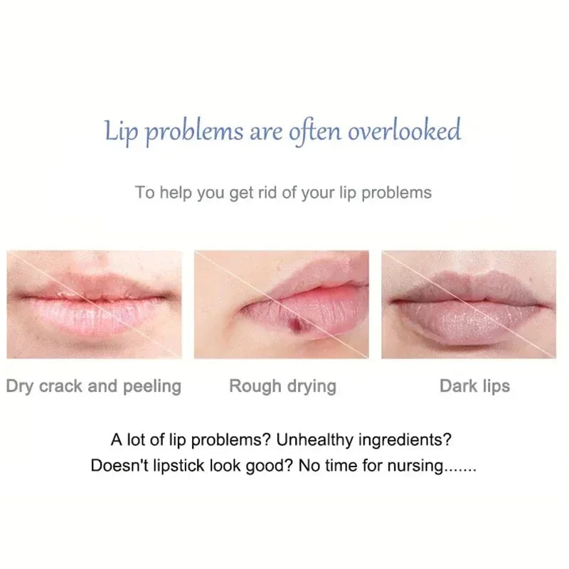 Moisturizing Lip Balm for Dark Pigmentation and Dryness Repair