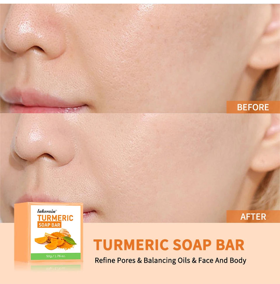 Brightening Turmeric Soap Bar for Face and Body Deep Cleansing - 9