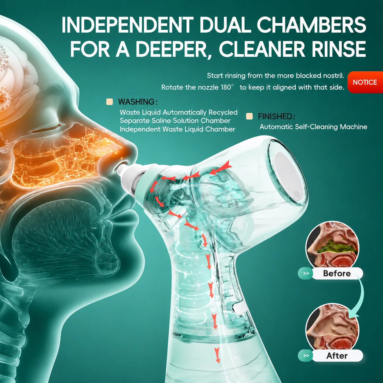 Electric Nasal Irrigator for Sinus Congestion and Allergy Relief - 4