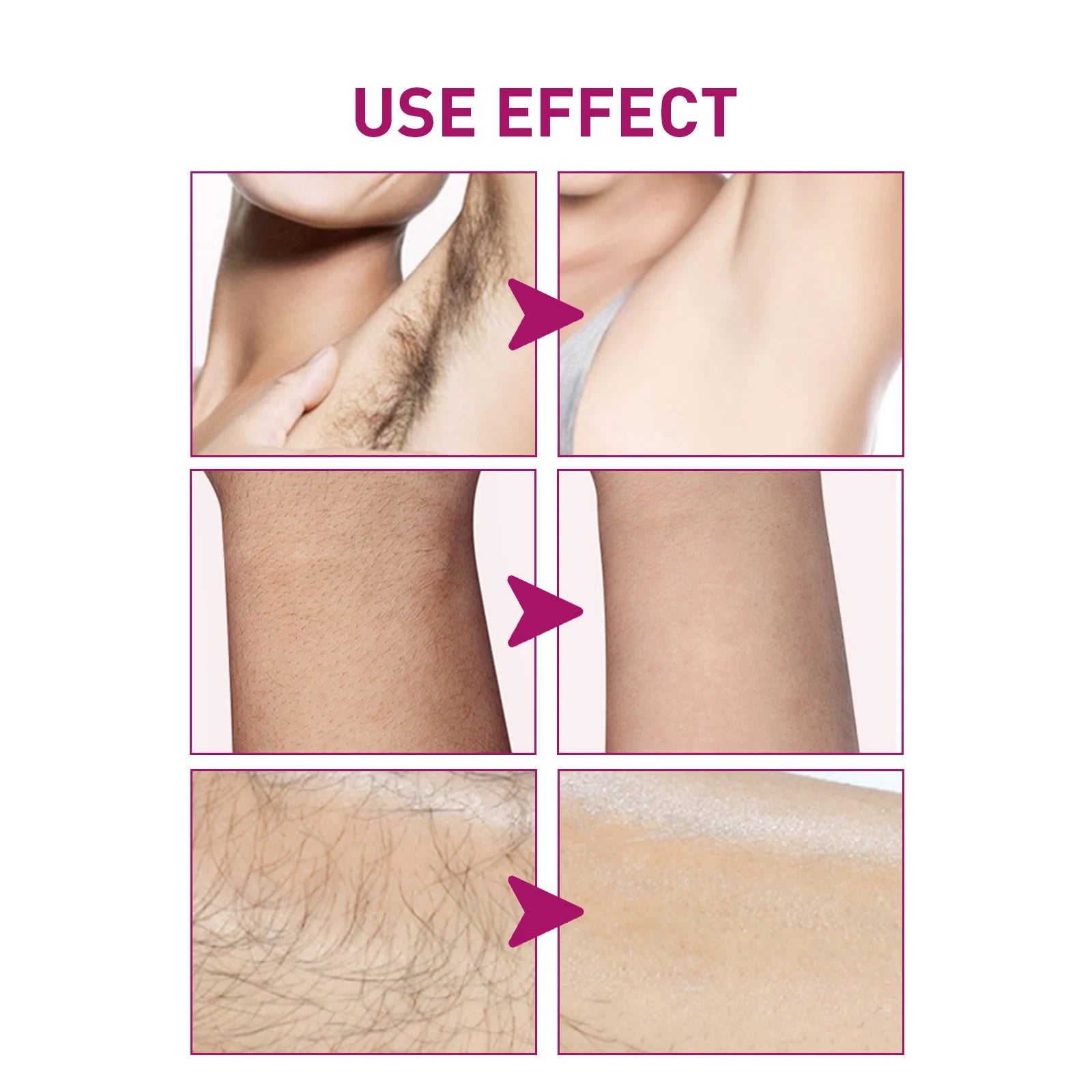 Painless Hair Removal Cream for Smooth Skin and Body Grooming - 4