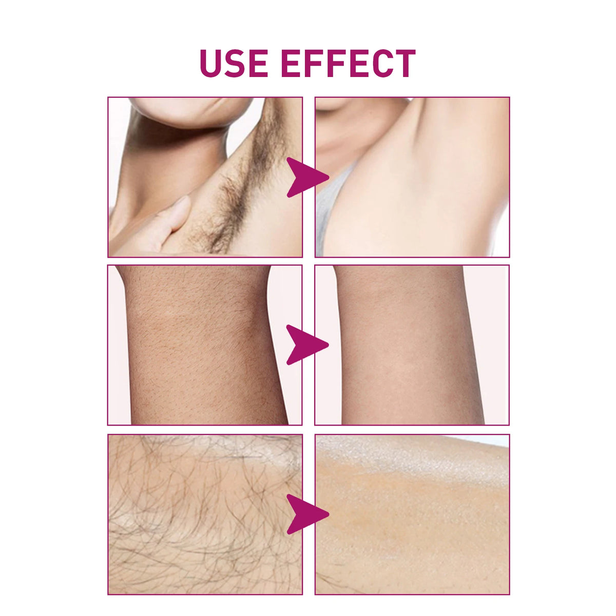 Painless Hair Removal Cream for Smooth Skin and Body Grooming