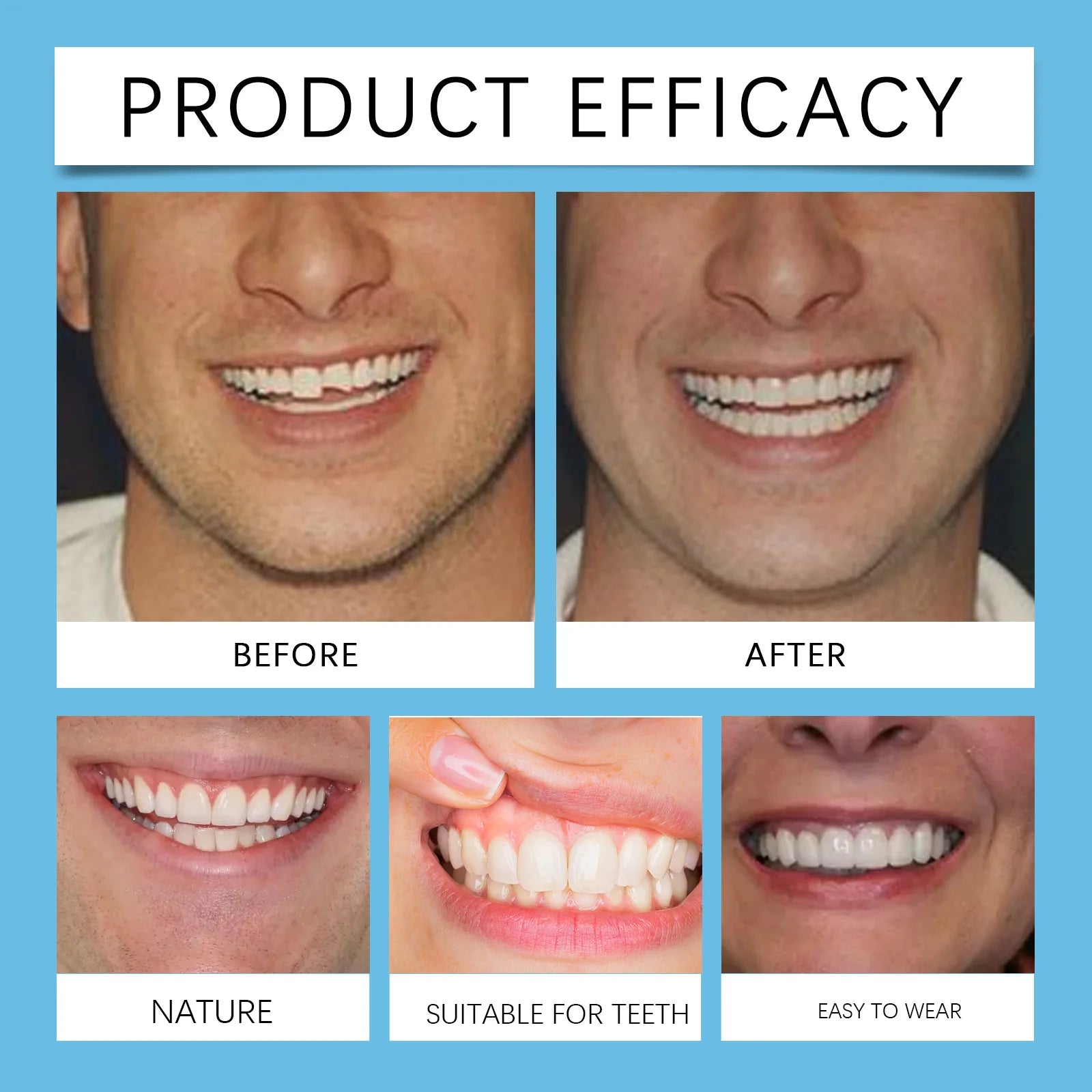 Snap-On Silicone Denture Set for Instant Smile Transformation - 19