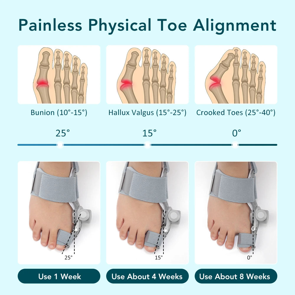 Adjustable Orthopedic Bunion Corrector for Painless Toe Alignment - 15