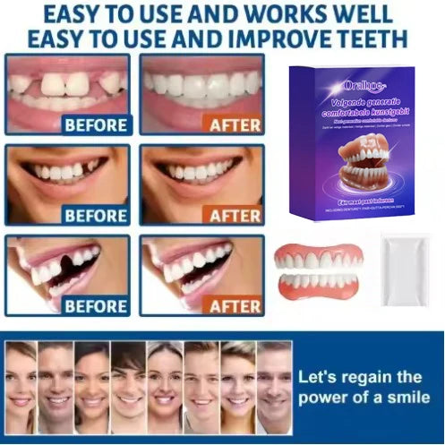 Soft Silicone Snap-On Denture Kit for Realistic Natural Looking Smile - 3