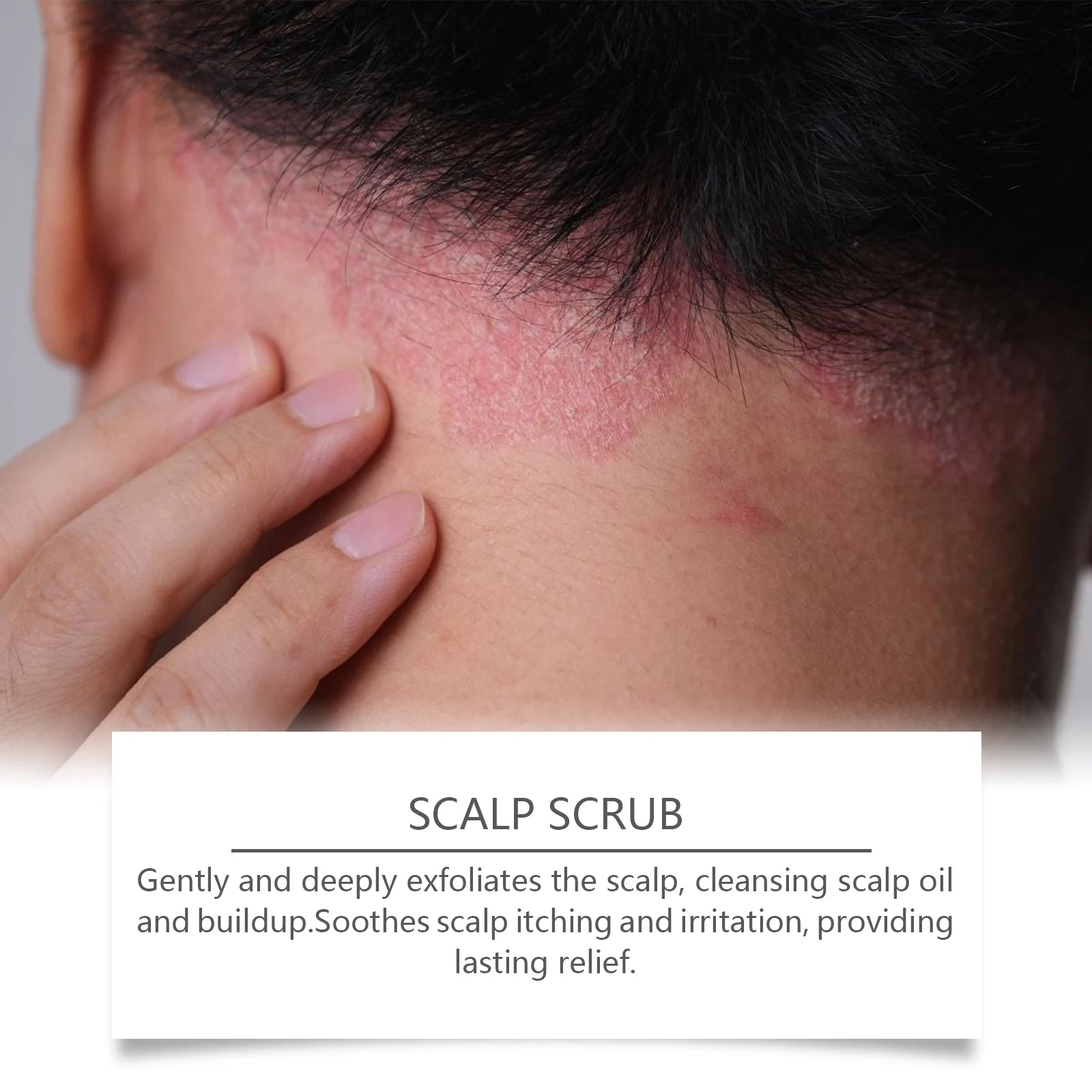 Deep Cleansing Scalp Exfoliator for Dandruff Relief and Oil Control - 9