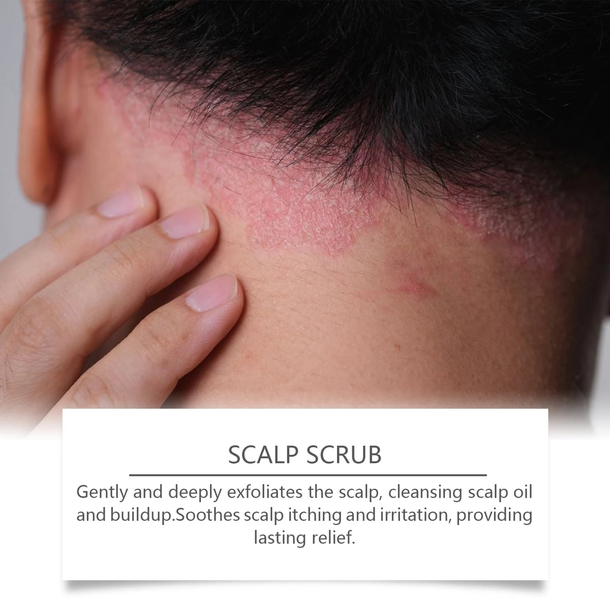 Deep Cleansing Scalp Exfoliator for Dandruff Relief and Oil Control
