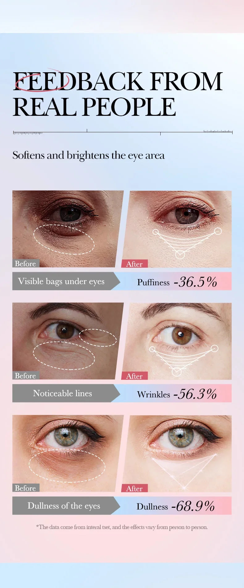 Anti-Wrinkle Retinol Eye Cream for Dark Circles and Puffiness - 17