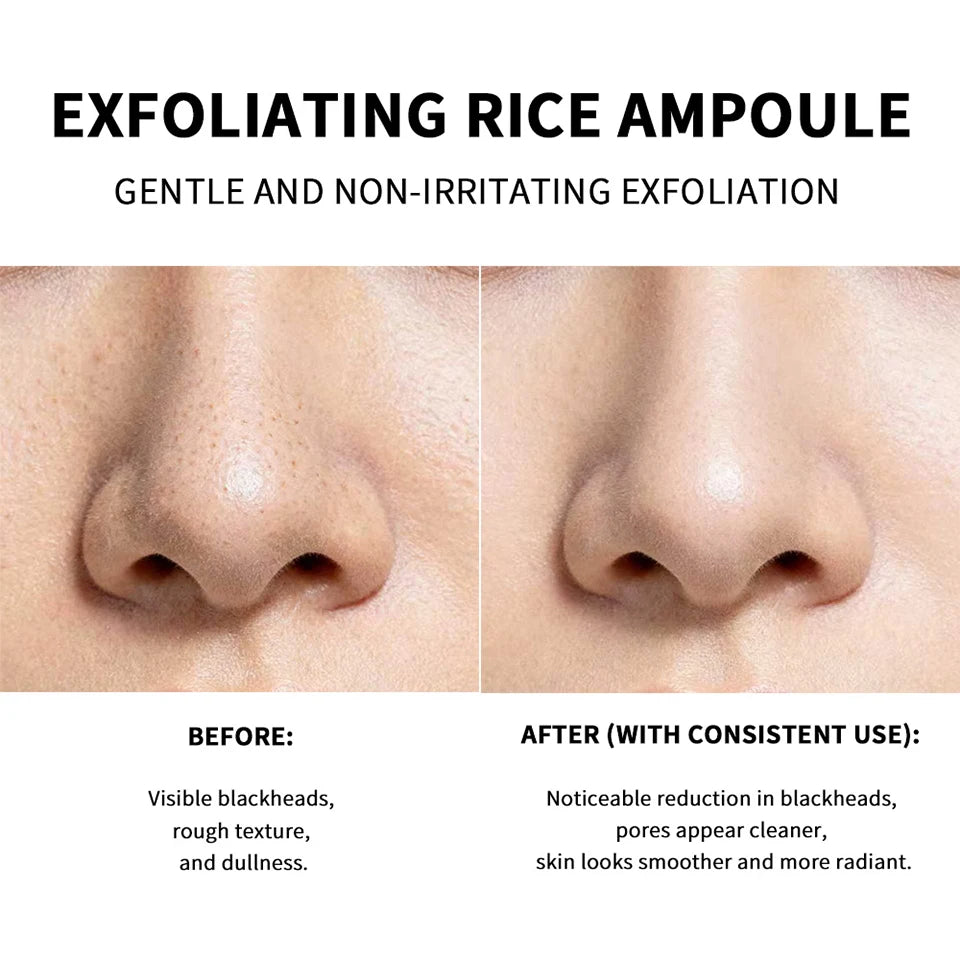 Exfoliating Rice Essence Serum for Deep Pore Cleansing and Skin Brightening - 11