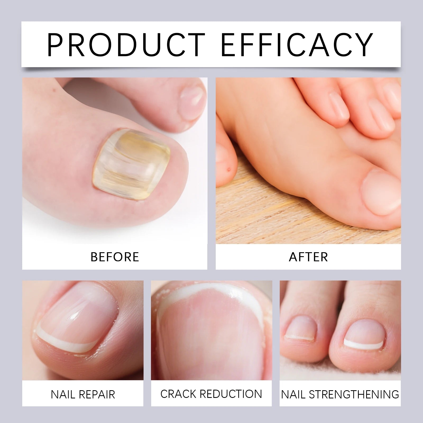 Nail Repair and Cuticle Nourishing Pen for Damaged and Brittle Nails - 18