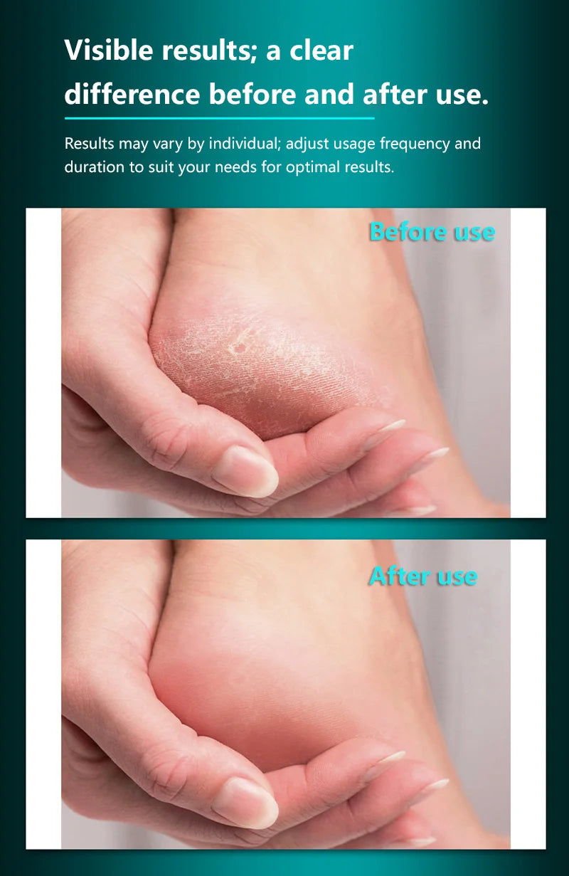 Professional Stainless Steel Foot File for Cracked Heels and Callus Removal