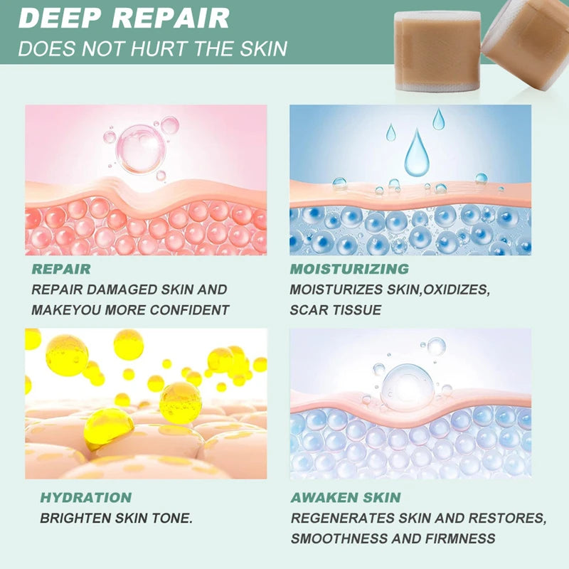 Reusable Silicone Gel Tape for Effective Scar Reduction and Skin Repair - 5
