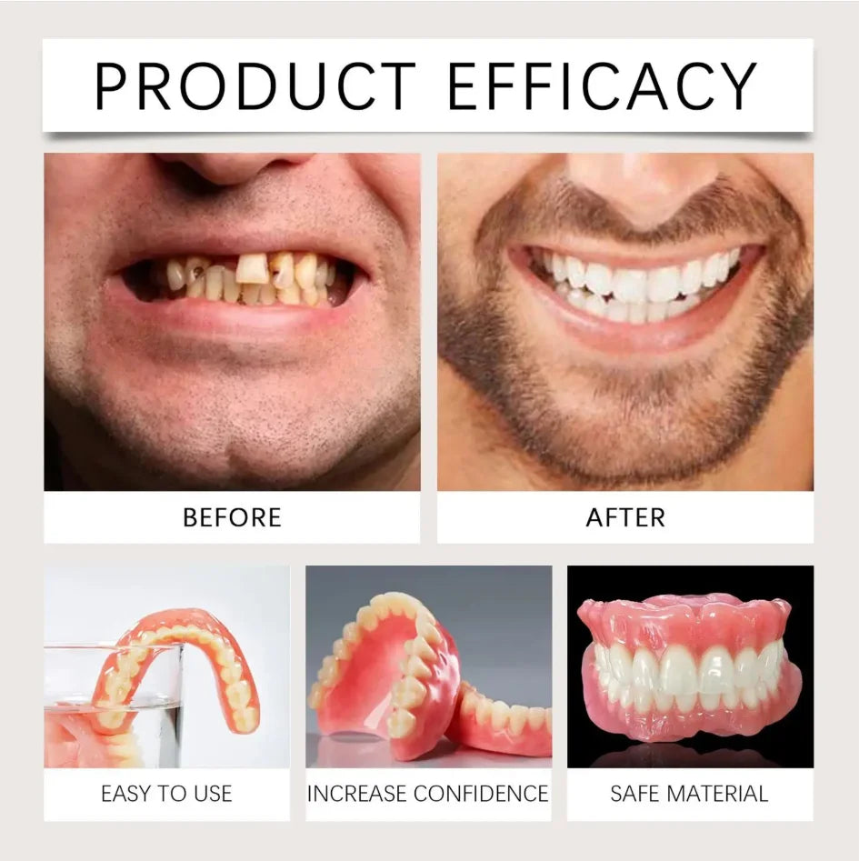 Instant Smile Cosmetic Dentures for Natural Looking Teeth and Confidence - 3