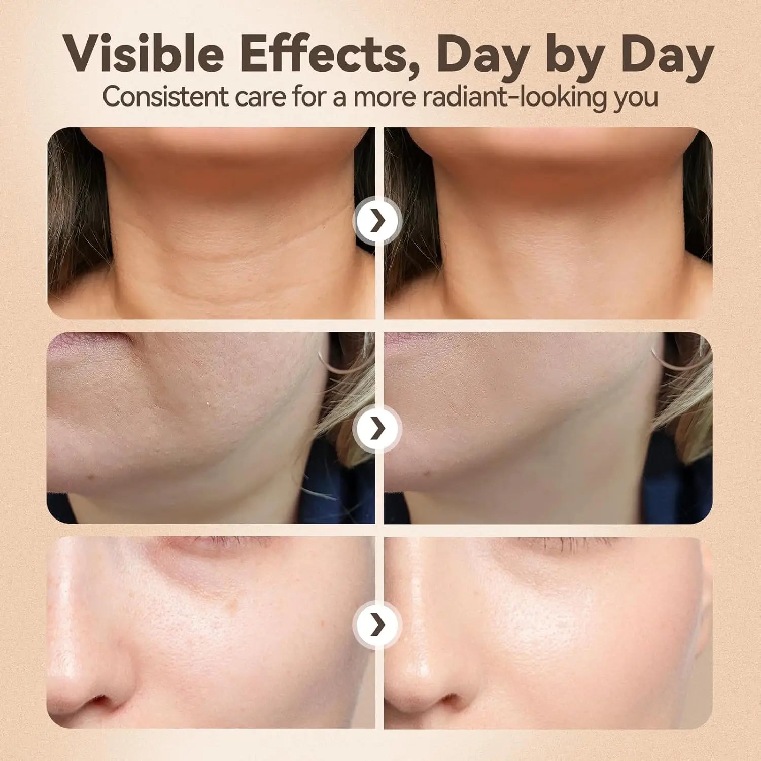 3-in-1 Facial Sculpting Massager for Skin Tightening and Jawline Lifting - 10