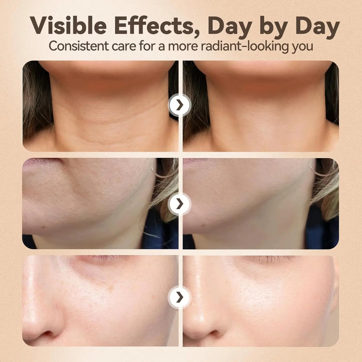 3-in-1 Facial Sculpting Massager for Skin Tightening and Jawline Lifting