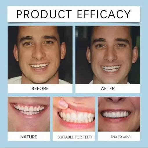Flexible Silicone Dentures for Natural Looking Smile and Comfort Fit