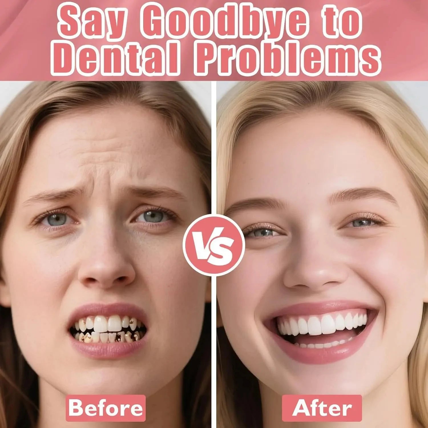 Realistic Temporary Denture Set for a Natural and Confident Smile - 10