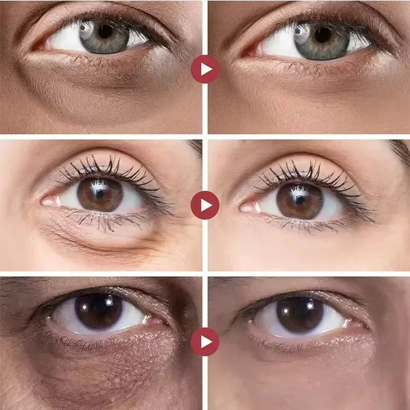 Anti-Wrinkle Retinol Eye Cream for Dark Circles and Puffiness - 9