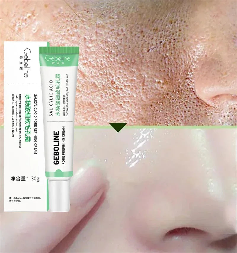 Salicylic Acid Pore Refining Cream for Smooth and Clear Skin