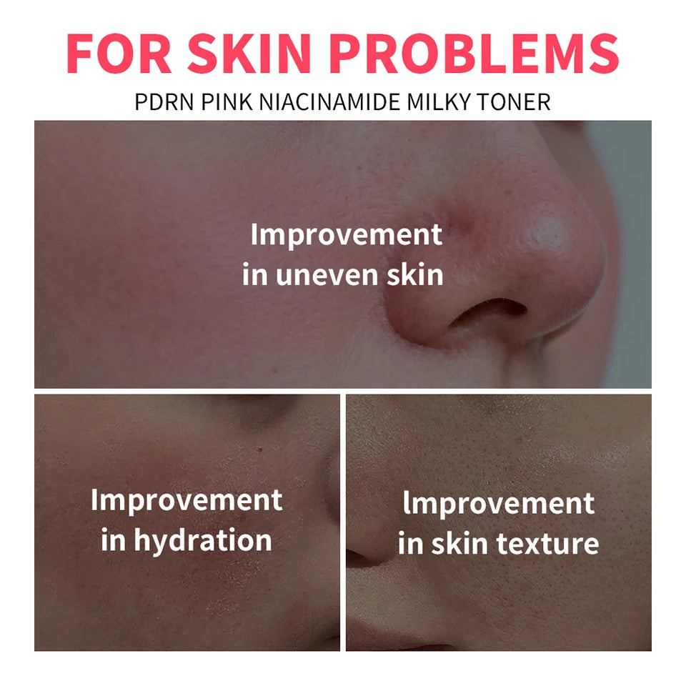 PDRN Niacinamide Milky Toner for Deep Hydration and Glowing Radiant Skin - 8