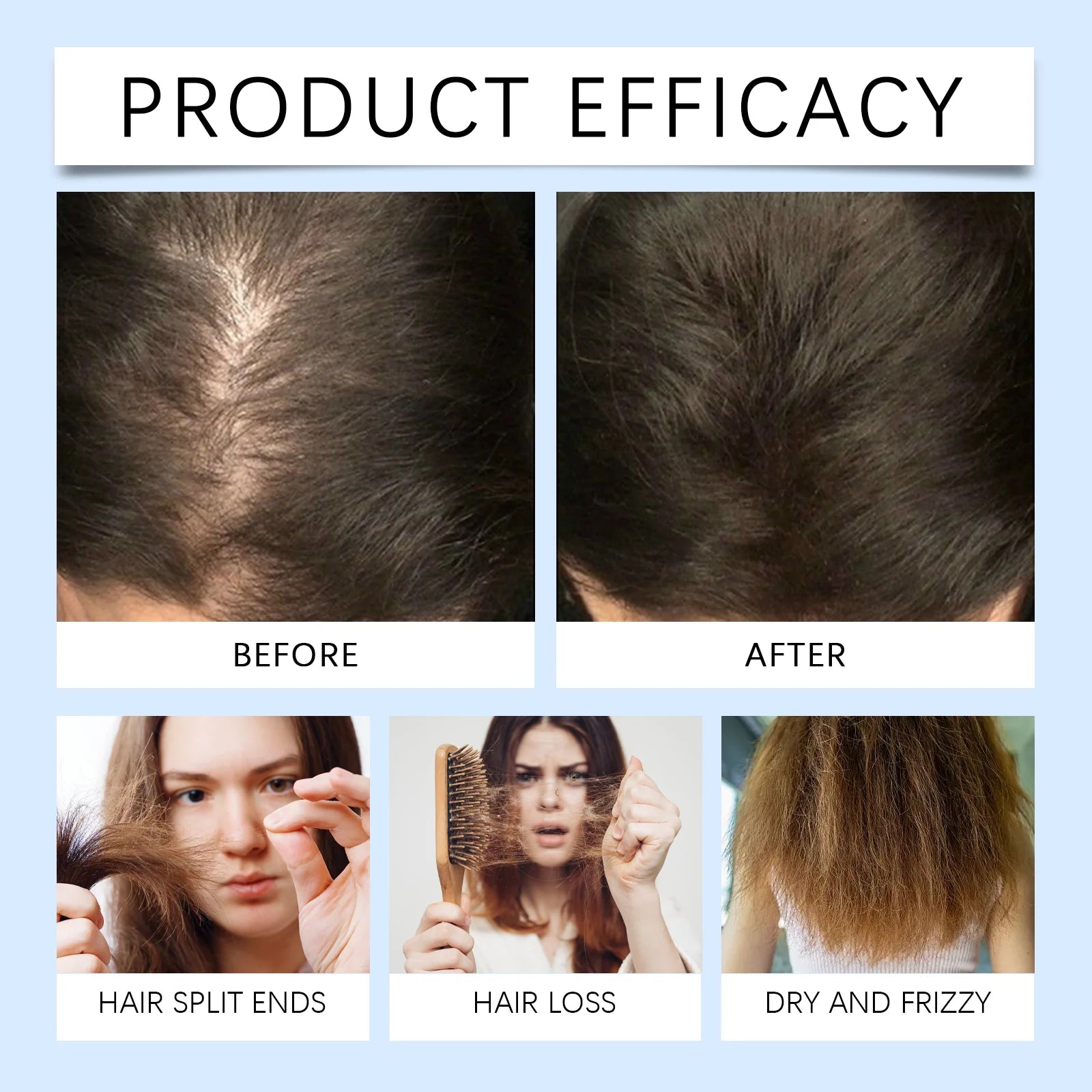 Rosemary Scalp Nourishing Serum Roller for Thicker and Fuller Hair - 10