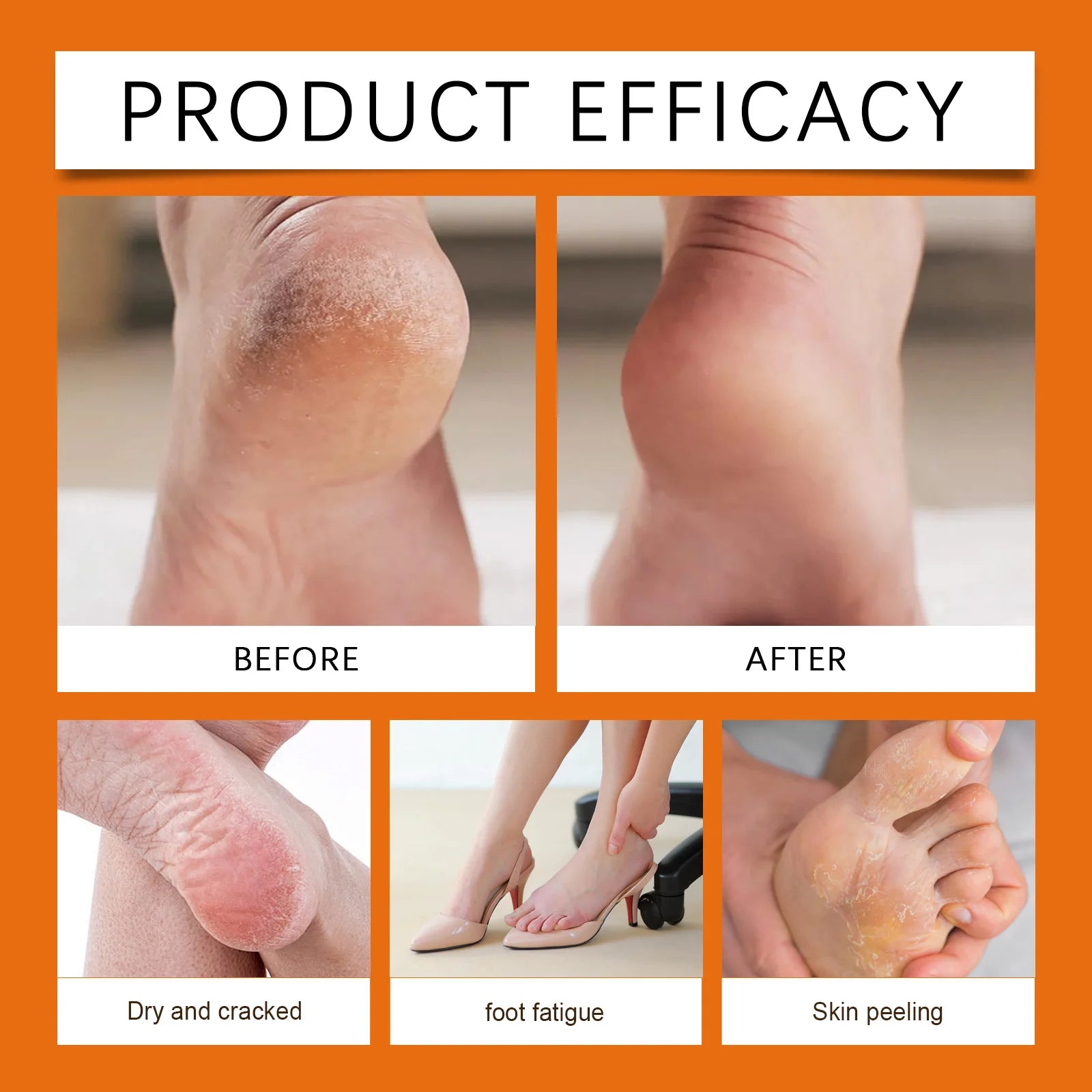 Moisturizing Healing Stick for Dry Cracked Heels and Rough Skin - 4